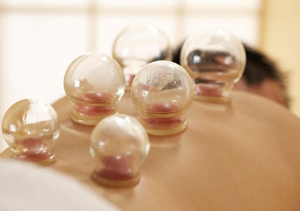 حجامت در روایات و احادیث اسلامی